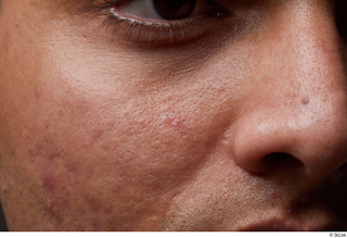 HD Face Skin Ithamar Jung cheek face nose skin pores…